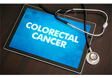 The Disease Susceptibility Genetic Test-Lung Cancer